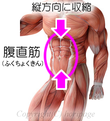 腹直筋の分解図